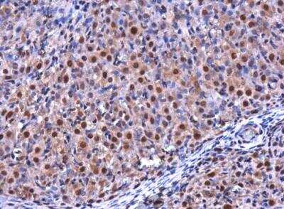 Immunohistochemistry-Paraffin: RGS2 Antibody [NBP1-32284]