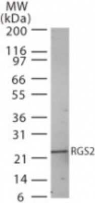 Western Blot: RGS2 Antibody [NB100-56736]