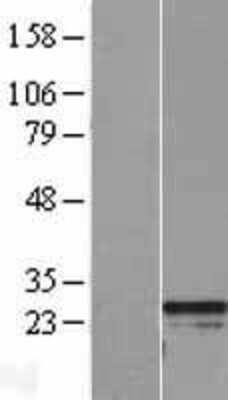 Western Blot: RGS2 Overexpression Lysate [NBL1-15327]