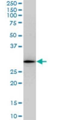 Western Blot: RGS20 Antibody (3E10) [H00008601-M04]