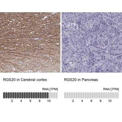 Immunohistochemistry-Paraffin: RGS20 Antibody [NBP2-62667]