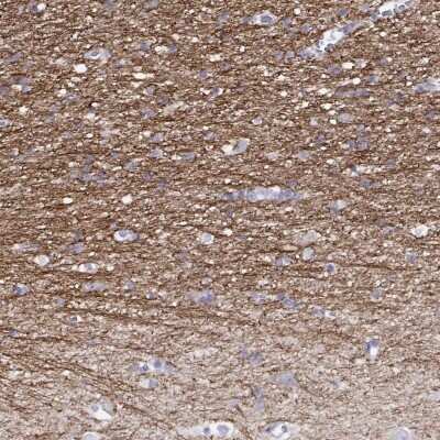 Immunohistochemistry-Paraffin: RGS20 Antibody [NBP2-62667]