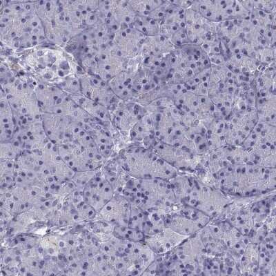 Immunohistochemistry-Paraffin: RGS20 Antibody [NBP2-62667]
