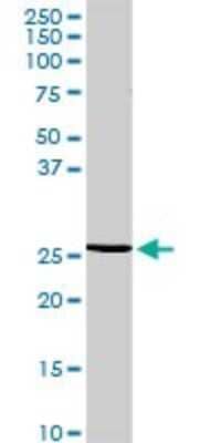 Western Blot: RGS20 Antibody [H00008601-D01P]