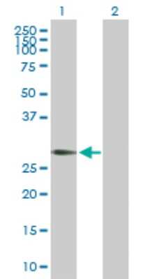 Western Blot: RGS20 Antibody [H00008601-D01P]