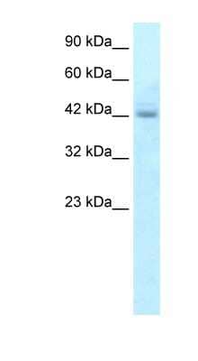 Western Blot: RGS20 Antibody [NBP1-54839]