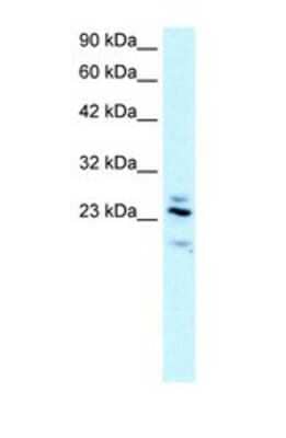 Western Blot: RGS20 Antibody [NBP1-54885]