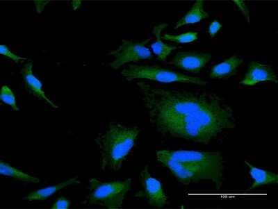 Immunocytochemistry/ Immunofluorescence: RGS21 Antibody [H00431704-B01P]
