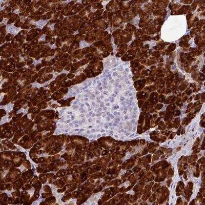 Immunohistochemistry-Paraffin: RGS21 Antibody [NBP2-13228]