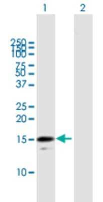 Western Blot: RGS21 Antibody [H00431704-B01P]