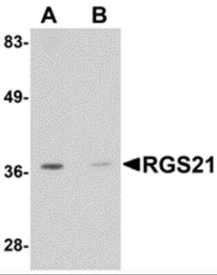 Western Blot: RGS21 AntibodyBSA Free [NBP2-81987]