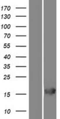 Western Blot: RGS21 Overexpression Lysate [NBP2-08566]