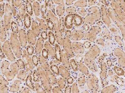 Immunohistochemistry-Paraffin: RGS22 Antibody [NBP3-06371]