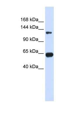 Western Blot: RGS22 Antibody [NBP1-56546]