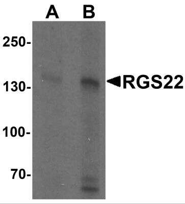 Western Blot: RGS22 AntibodyBSA Free [NBP2-81776]