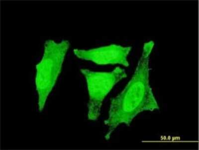 Immunocytochemistry/ Immunofluorescence: RGS3 Antibody (1E8-C7) [H00005998-M01]