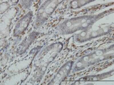 Immunohistochemistry-Paraffin: RGS3 Antibody (1E8-C7) [H00005998-M01]
