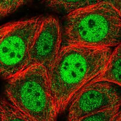 Immunocytochemistry/ Immunofluorescence: RGS3 Antibody [NBP2-58942]