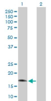 Western Blot: RGS3 Antibody [H00005998-B01P]