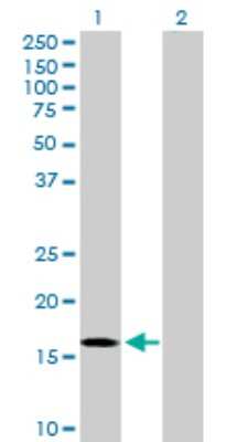 Western Blot: RGS3 Antibody [H00005998-D01P]