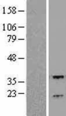 Western Blot: RGS3 Overexpression Lysate [NBL1-15331]