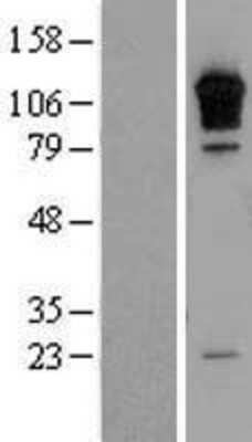 Western Blot: RGS3 Overexpression Lysate [NBL1-15332]