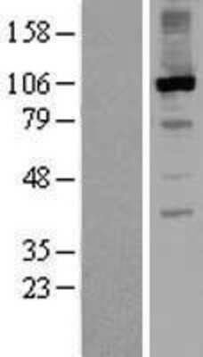 Western Blot: RGS3 Overexpression Lysate [NBL1-15333]