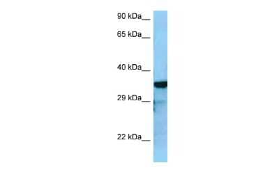 Western Blot: RGS4 Antibody [NBP2-82339]