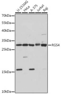 Western Blot: RGS4 AntibodyAzide and BSA Free [NBP2-94071]