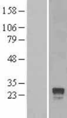 Western Blot: RGS4 Overexpression Lysate [NBL1-15334]