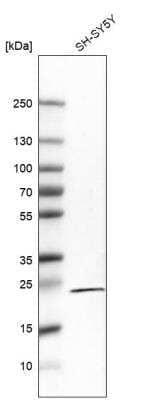 Western Blot: RGS5 Antibody (CL5568) [NBP2-61419]