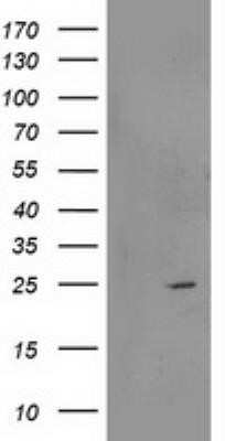 Western Blot: RGS5 Antibody (OTI1C1)Azide and BSA Free [NBP2-73887]