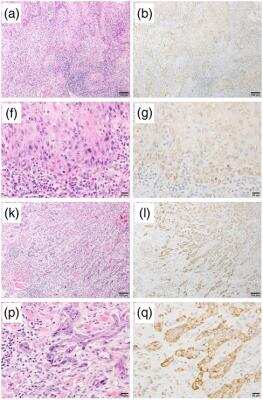 Immunohistochemistry: RGS5 Antibody (OTI1C1) [NBP2-00880]