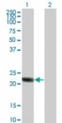 Western Blot: RGS5 Antibody [NBP2-24945]