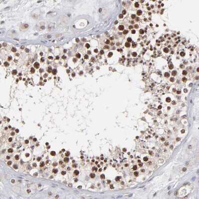 Immunohistochemistry-Paraffin: RGS6 Antibody [NBP1-86524]