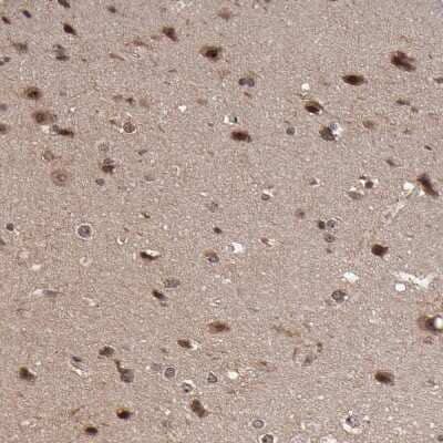 Immunohistochemistry-Paraffin: RGS6 Antibody [NBP1-86524]