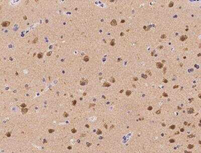 Immunohistochemistry-Paraffin: RGS6 Antibody [NBP3-06581]