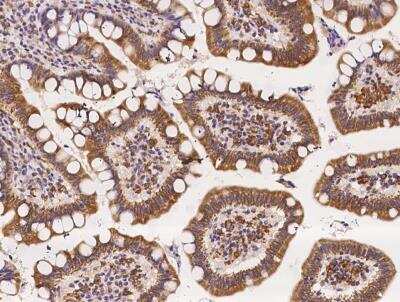 Immunohistochemistry-Paraffin: RGS6 Antibody [NBP3-06581]