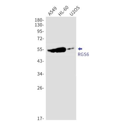 Western Blot: RGS6 Antibody (S02-1D3) [NBP3-19913]