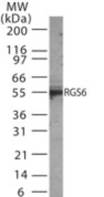 Western Blot: RGS6 Antibody [NB100-56659]