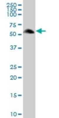 Western Blot: RGS7 Antibody [H00006000-B01P]