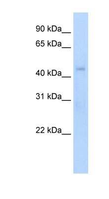 Western Blot: RGS7 Antibody [NBP1-80513]