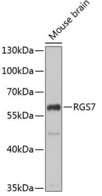 Western Blot: RGS7 AntibodyBSA Free [NBP2-94109]