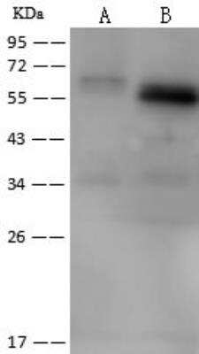 Western Blot: RGS7 Antibody [NBP3-12720]