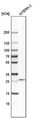 Western Blot: RGS7BP Antibody [NBP2-14504]