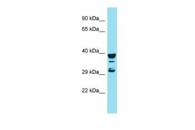 Western Blot: RGS7BP Antibody [NBP2-83444]