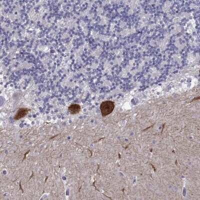 Immunohistochemistry-Paraffin: RGS8 Antibody [NBP2-69025]