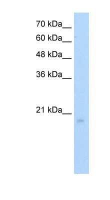 Western Blot: RGS8 Antibody [NBP1-80510]