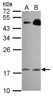 Western Blot: RGS8 Antibody [NBP2-20153]