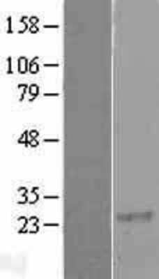 Western Blot: RGS8 Overexpression Lysate [NBL1-15338]